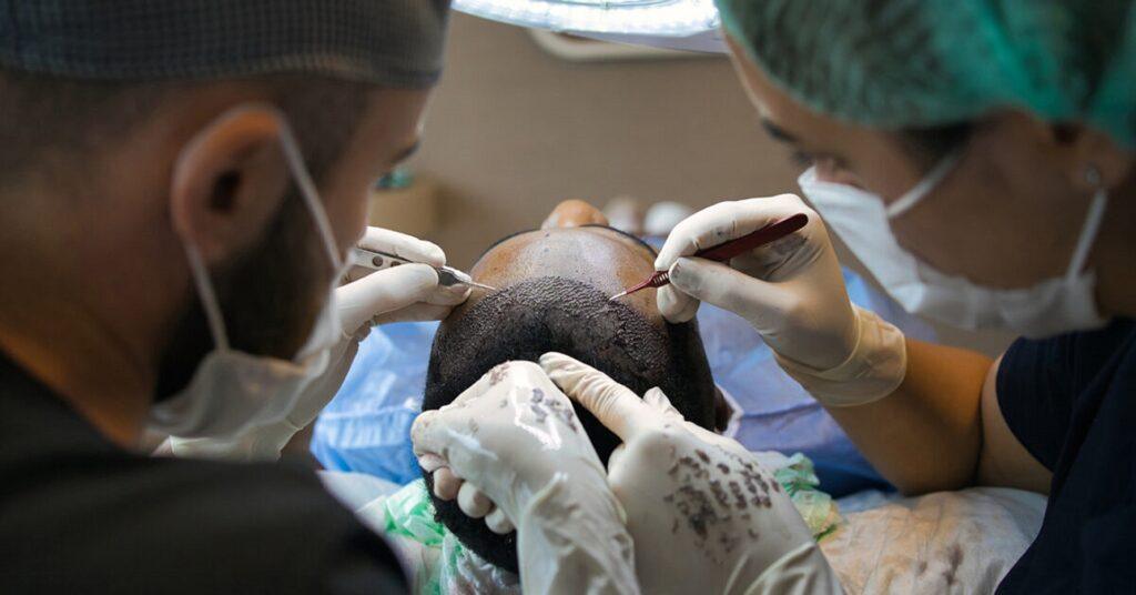 Hair Transplant Operation