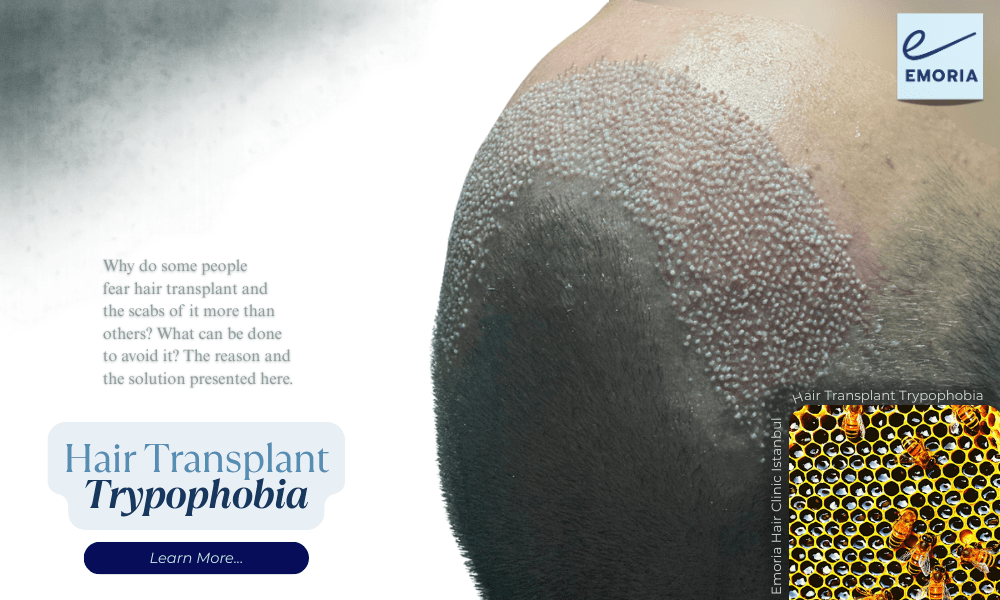 Hair Transplant Trypophobia