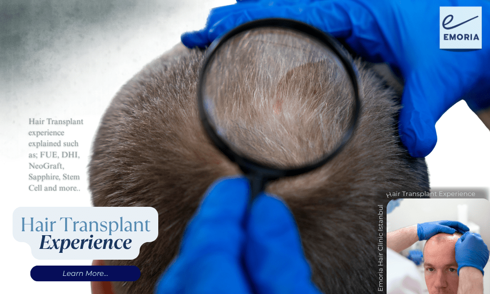 Hair Transplant Experience in Turkey